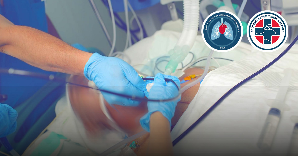 Curso de Consideraciones Anestésicas en Cirugía Torácica Urgencia y Patología Torácica/Pulmonar 2026