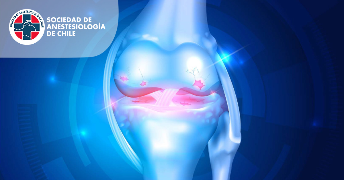 CP3: Anestesia/analgesia para cirugía de Rodilla