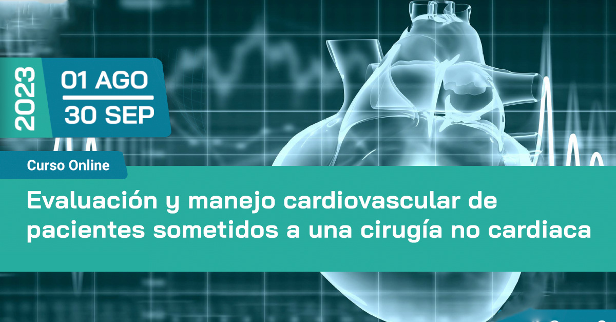  Actualización sobre evaluación y manejo cardiovascular de pacientes sometidos a una cirugía no cardiaca